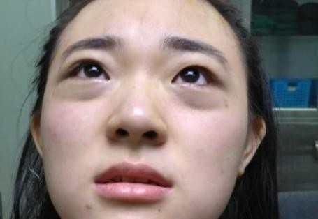 女工因黑眼圈被辞退引爆网络热议，背后真相究竟如何？