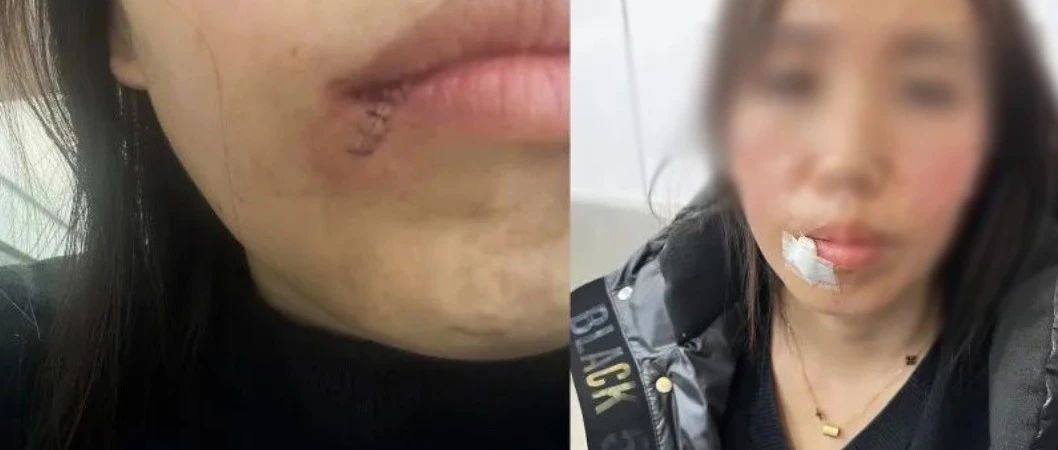 女子坠亡后牙齿被拔引发争议，真相究竟如何？